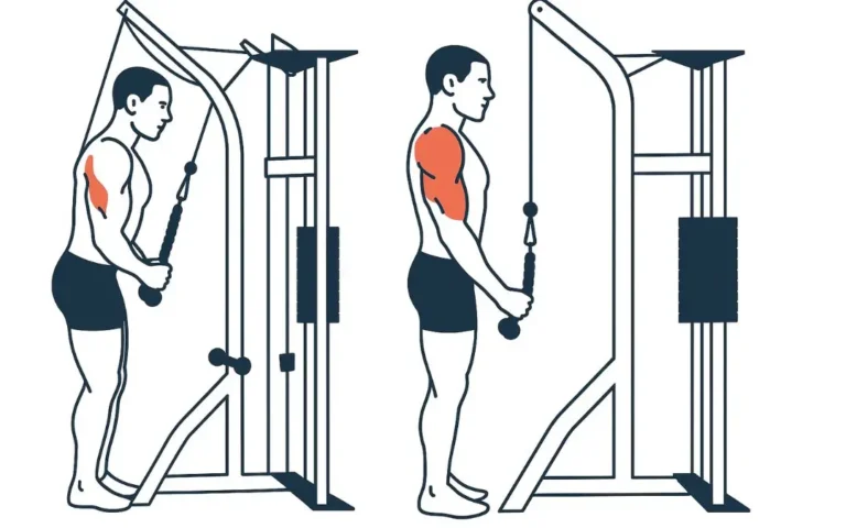 Extension triceps poulie haute